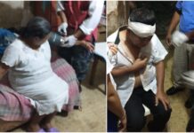 Matrimonio yucateco al hospital tras reventarse la soga de su hamaca