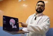 IMSS Yucatán logra primera cirugía cerebral en adolescente