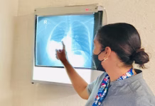 Asma, tratamiento oportuno para evitar complicaciones