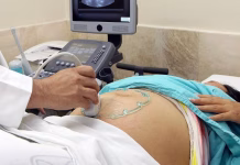 Depresión y ansiedad en consultas prenatales: IMSS Depresión y ansiedad en consultas prenatales: IMSS