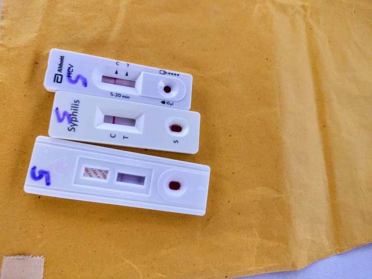 México autoriza lenacapavir para prevenir el VIH